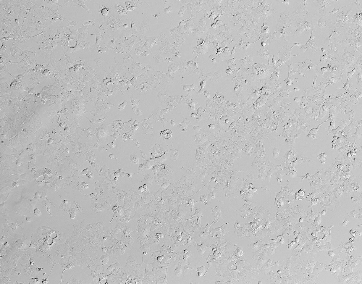 人子宫膜腺癌细胞（HEC-1-B）